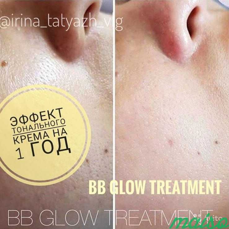 BB Glow Treatment-эффект тонального крема на 1 год в Москве. Фото 5