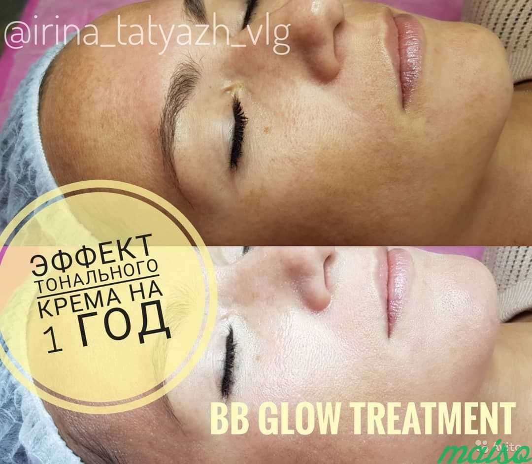 BB Glow Treatment-эффект тонального крема на 1 год в Москве. Фото 2