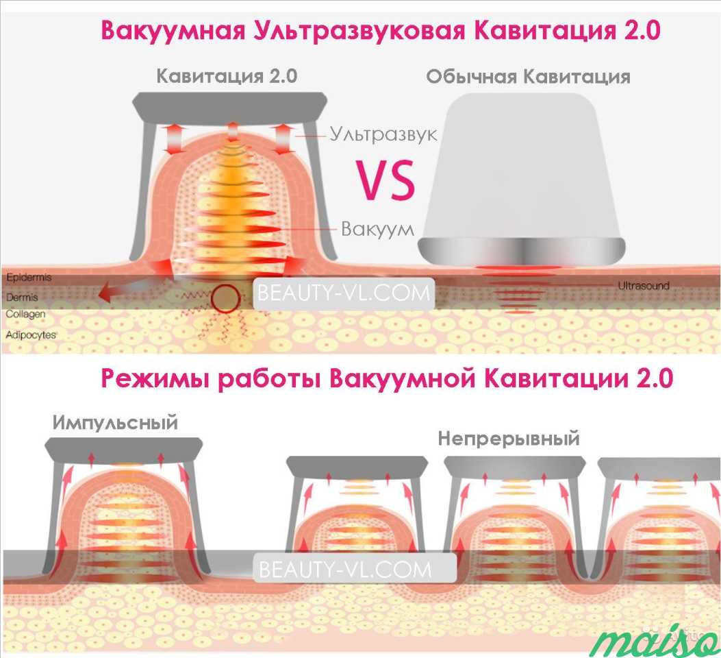 Кавитация это. Кавитация схема воздействия. Схема кавитации тела. Вакуумная ультразвуковая кавитация. Ультразвуковая кавитация схема.
